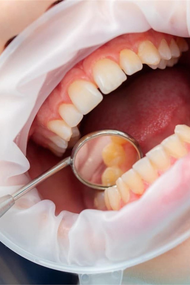 Cuidado bucodental integral
