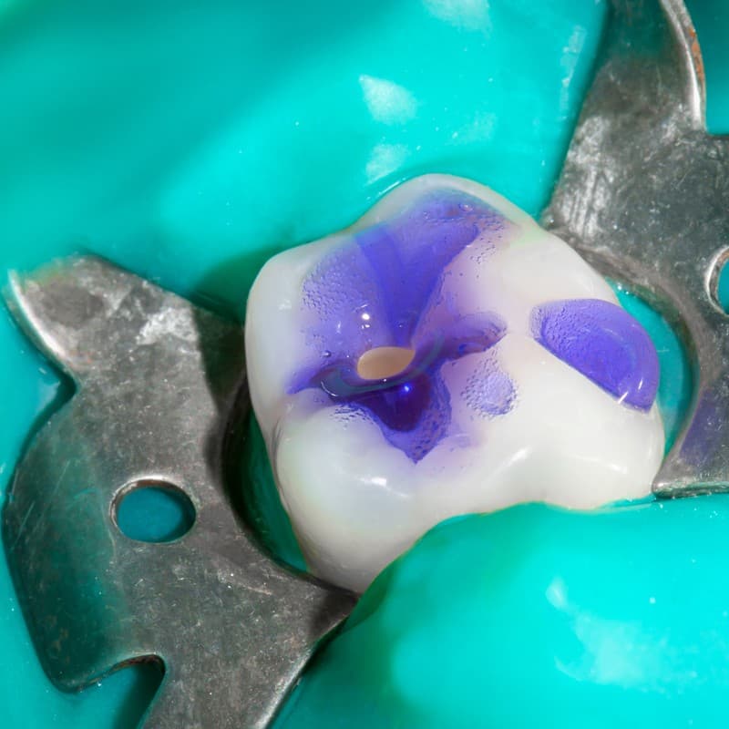 Endodoncia