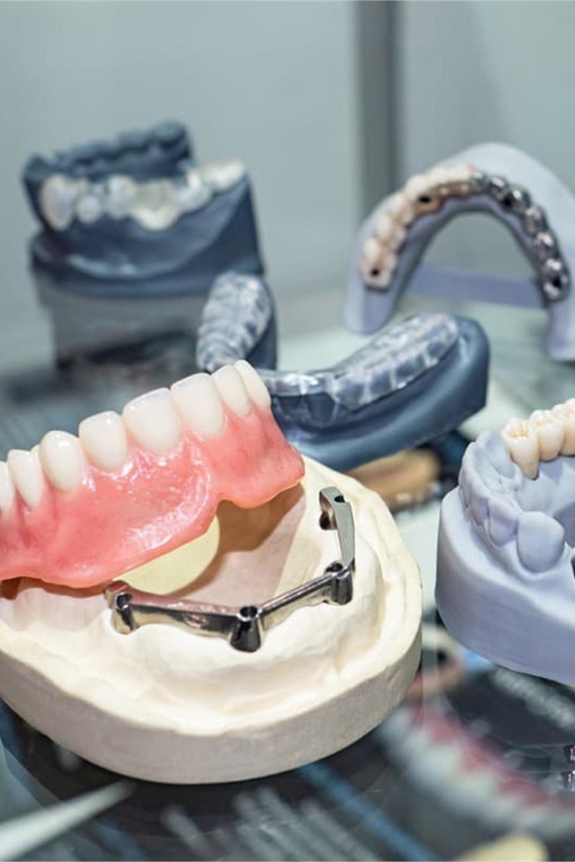 ¿Te faltan piezas dentales?